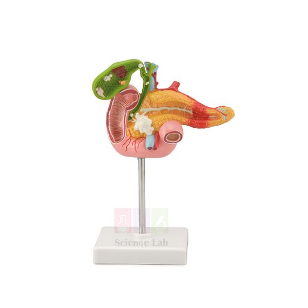 Pathology of the Human Pancreas, Duodenum, and Gallbladder Model